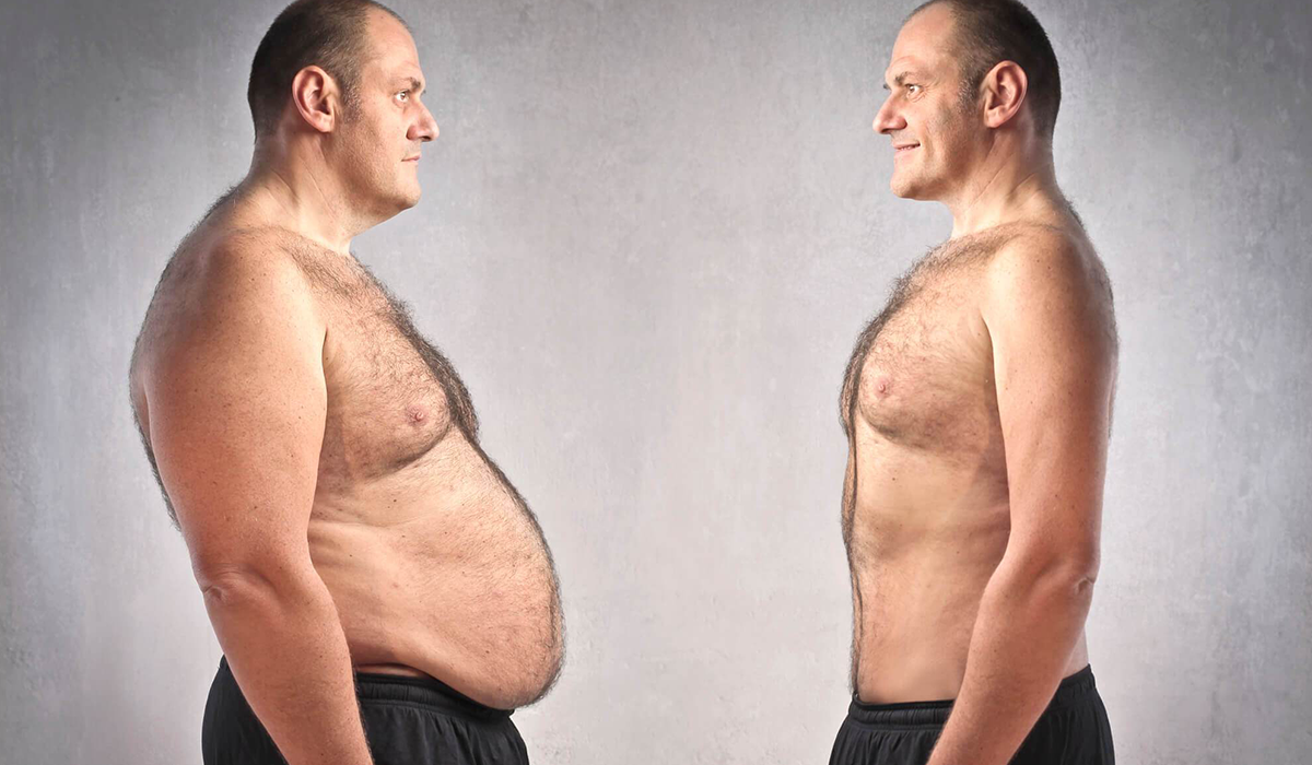 44 metų vyro svorio kritimas riebalų degintojas italia