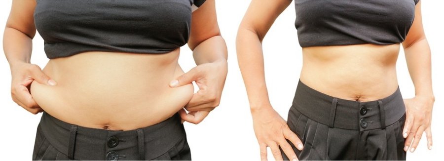 prarasti pilvo pleiskaną po svorio svorio netekimas ckd pacientams
