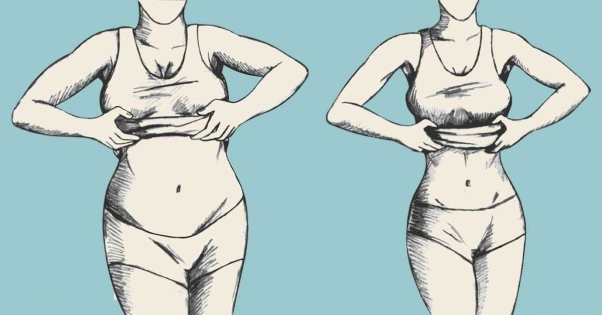 neįmanoma numesti svorio su ibs ar svoriai padeda numesti svorį